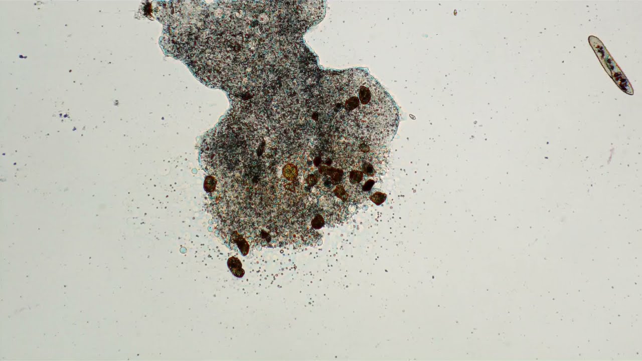Amoeba ruptures cell membrane... and dies