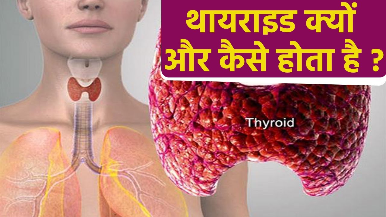 थायराइड की बीमारी क्यों और कैसे होती है? जानिए कारण और बचाव के उपाय । Boldsky *Health
