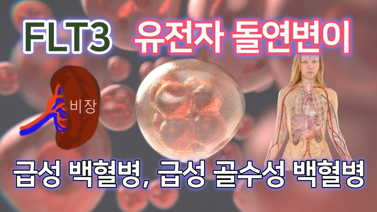 FLT3 유전자 돌연변이 - 급성 백혈병, 급성 골수성 백혈병
