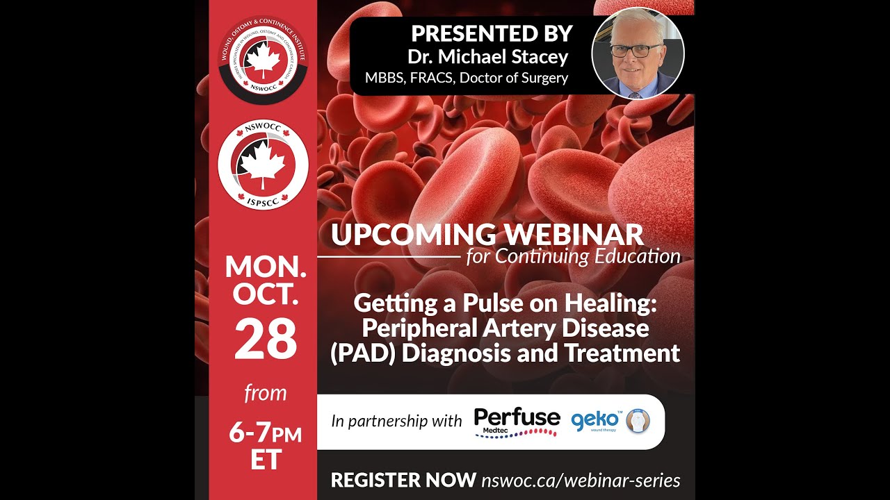 Getting a Pulse on Healing: Peripheral Artery Disease (PAD) Diagnosis and Treatment
