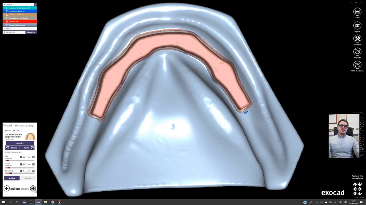 DGSHAPE: Exocad 2.4 Offest substructure on scanned bar