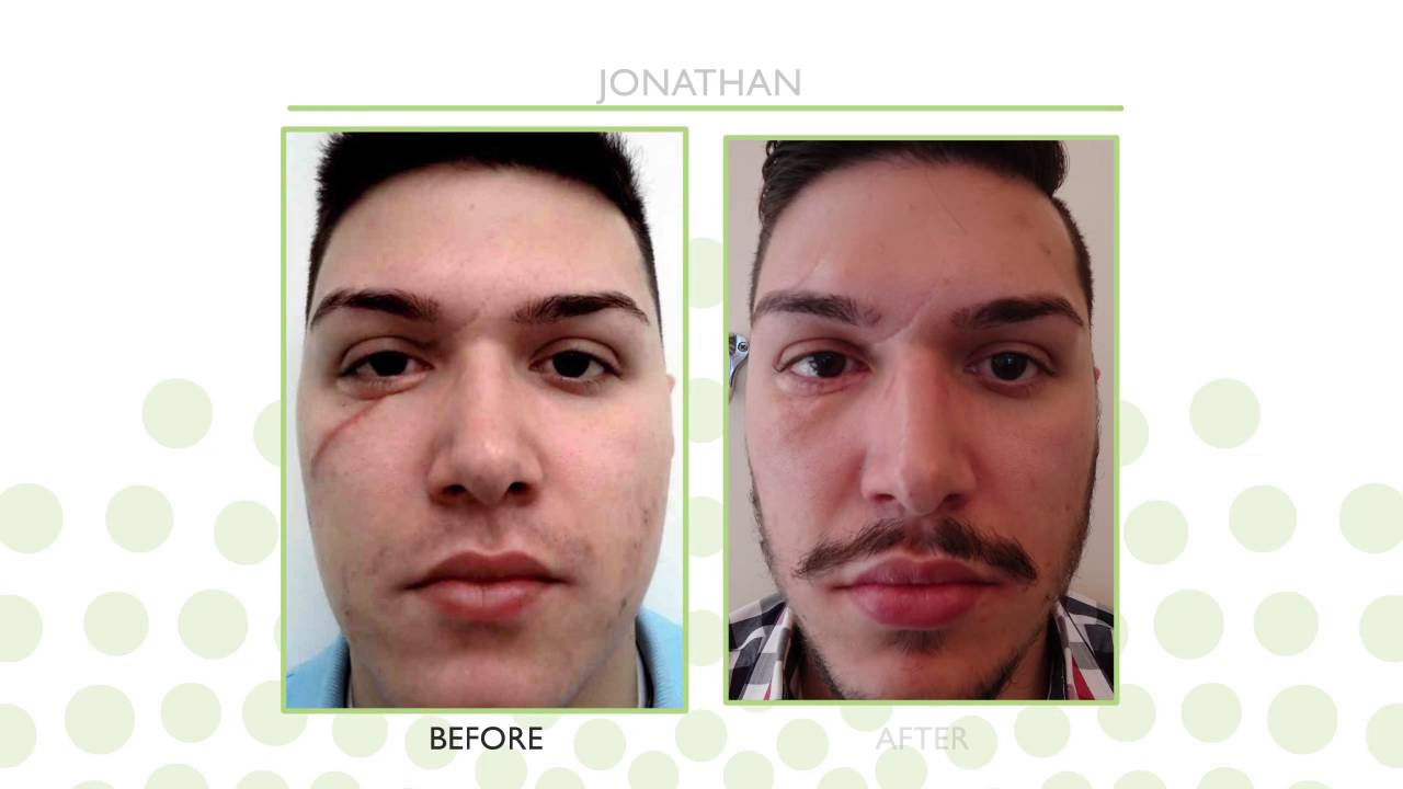 How Dr. Kelleher Helped Heal Facial Lacerations