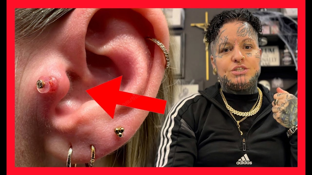 Лечение пирсинга ⚠️ Что такое келоид ⁉️ Все, что вам нужно знать