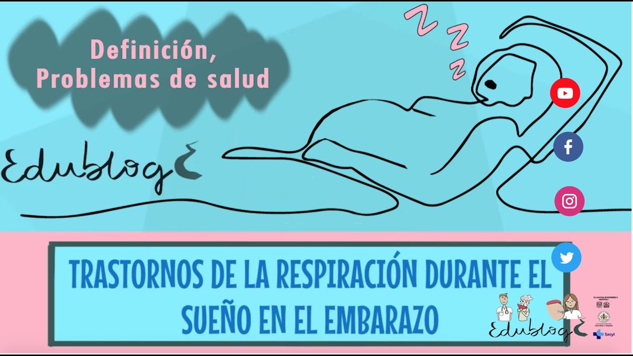 Apnea del sueño en embarazadas (parte 1)