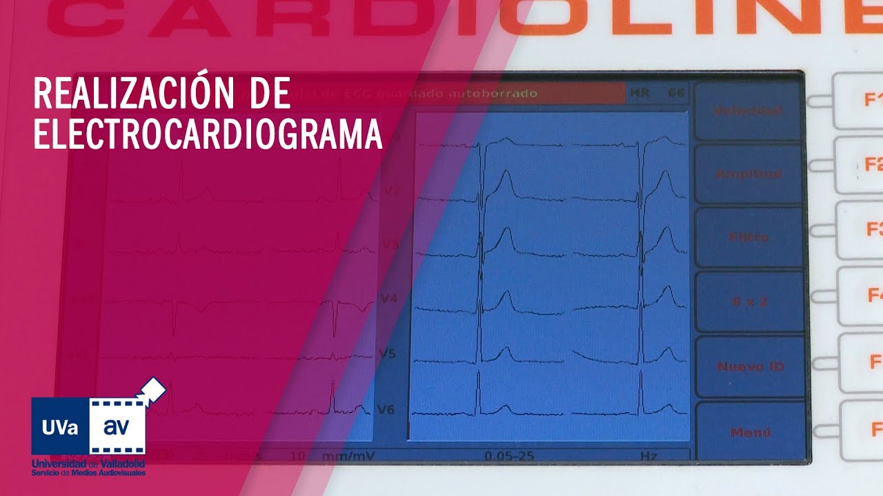 REALIZACIÓN DE ELECTROCARDIOGRAMA