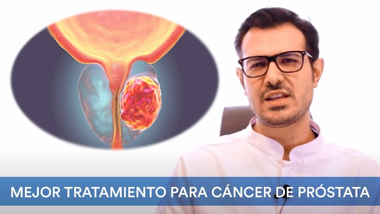 ¿Cuál es el mejor tratamiento para cáncer de próstata?