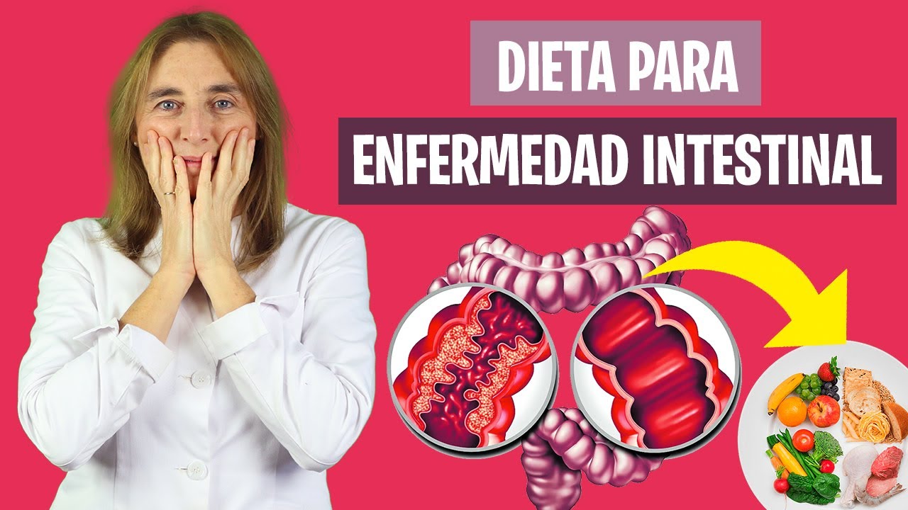 Dieta ENFERMEDAD INFLAMATORIA INTESTINAL | Enfermedad intestinal y dieta | Nutrición y Dietética