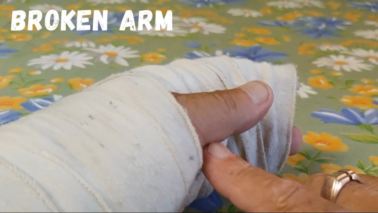 Broken arm (сломал руку)