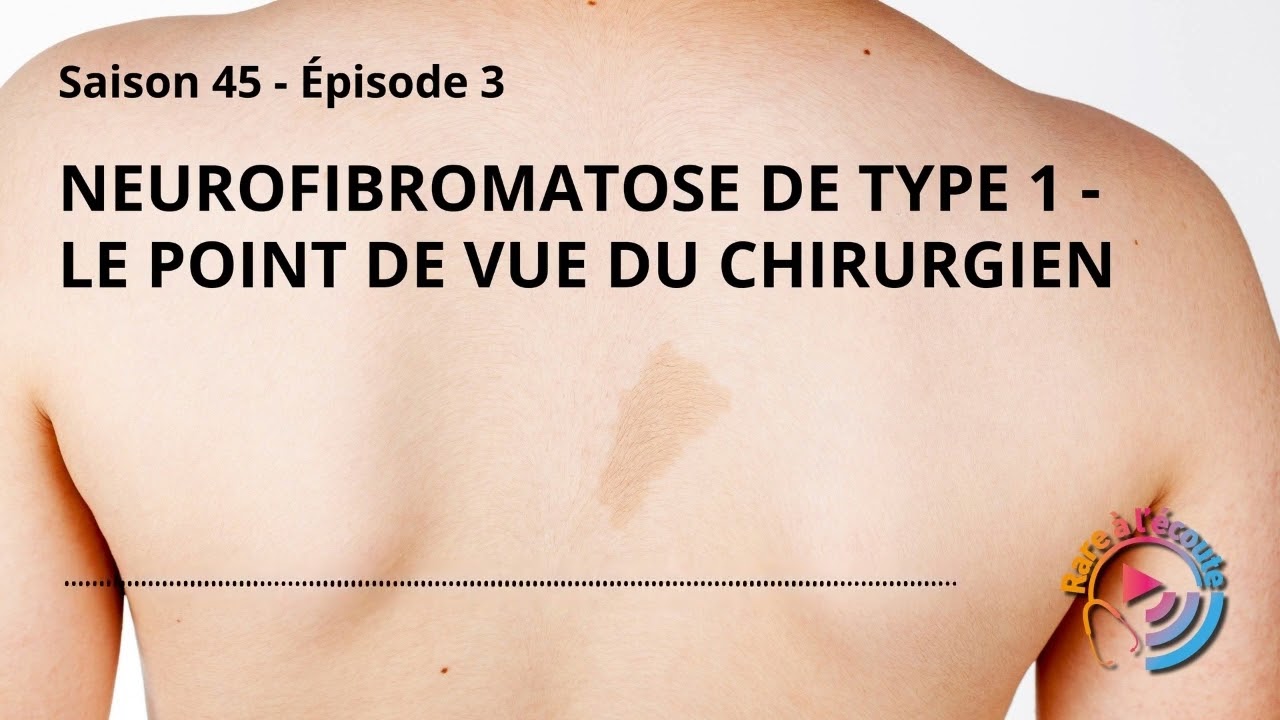Maladie rare - Neurofibromatose de type 1 – le point de vue du chirurgien