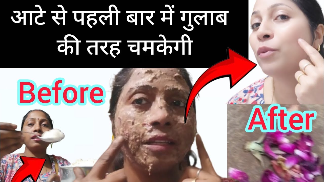 आटे से पहली बार में गुलाब जैसी चमक 🌹 | Instant Face Glow Remedy | Before After Result