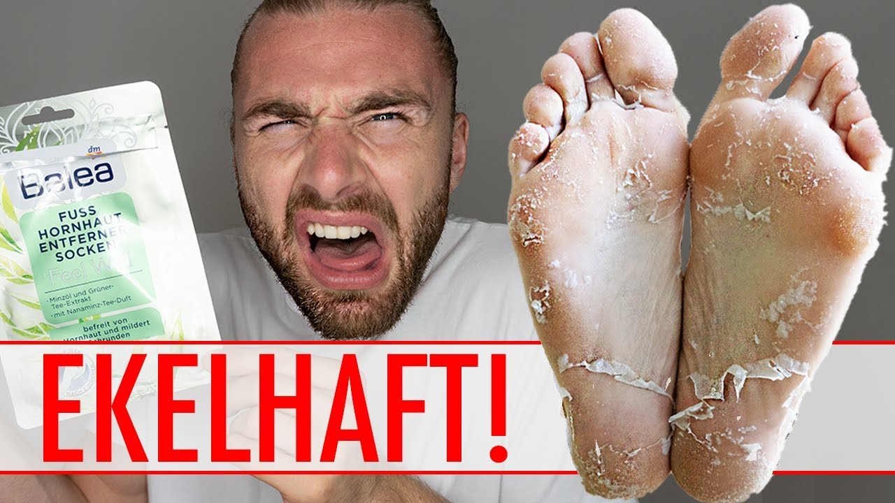 HORNHAUT ENTFERNEN mit HORNHAUTSOCKEN ● EKELHAFT, aber GEIL!