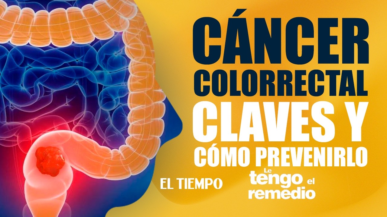 Claves para la prevención y tratamiento del cáncer colorrectal | Le tengo el remedio