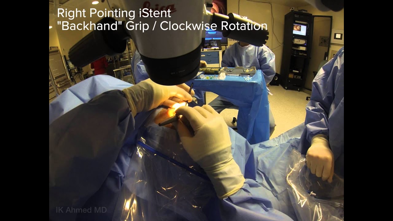 iStent Handposition view Ike Ahmed Narration (1080p).m4v