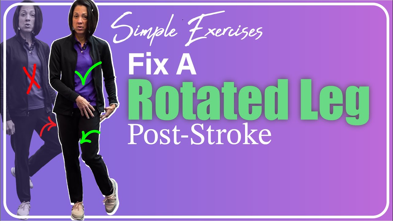 Correcting Outward LEG ROTATION After Neurologic Injury