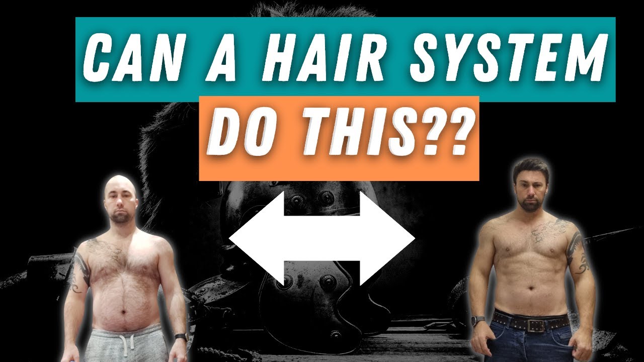 hair system for men | my journey so far