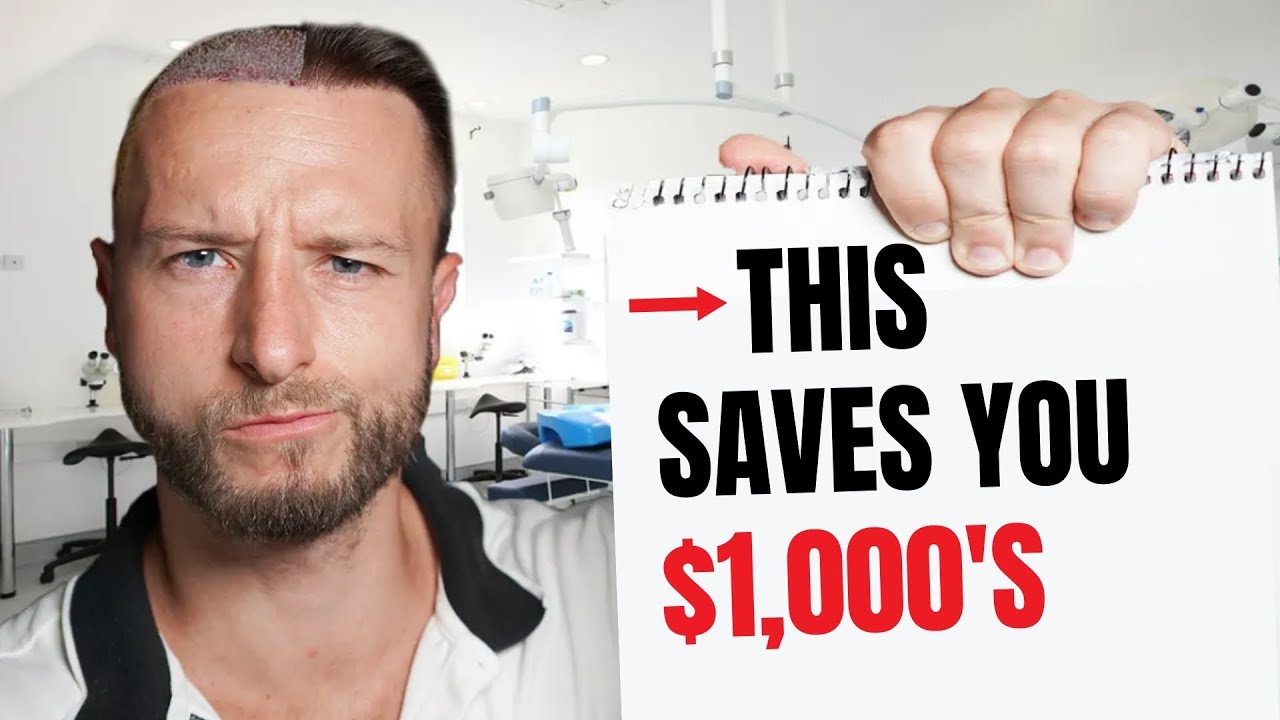 7 Years of Hair Transplant Advice in 7 Minutes!