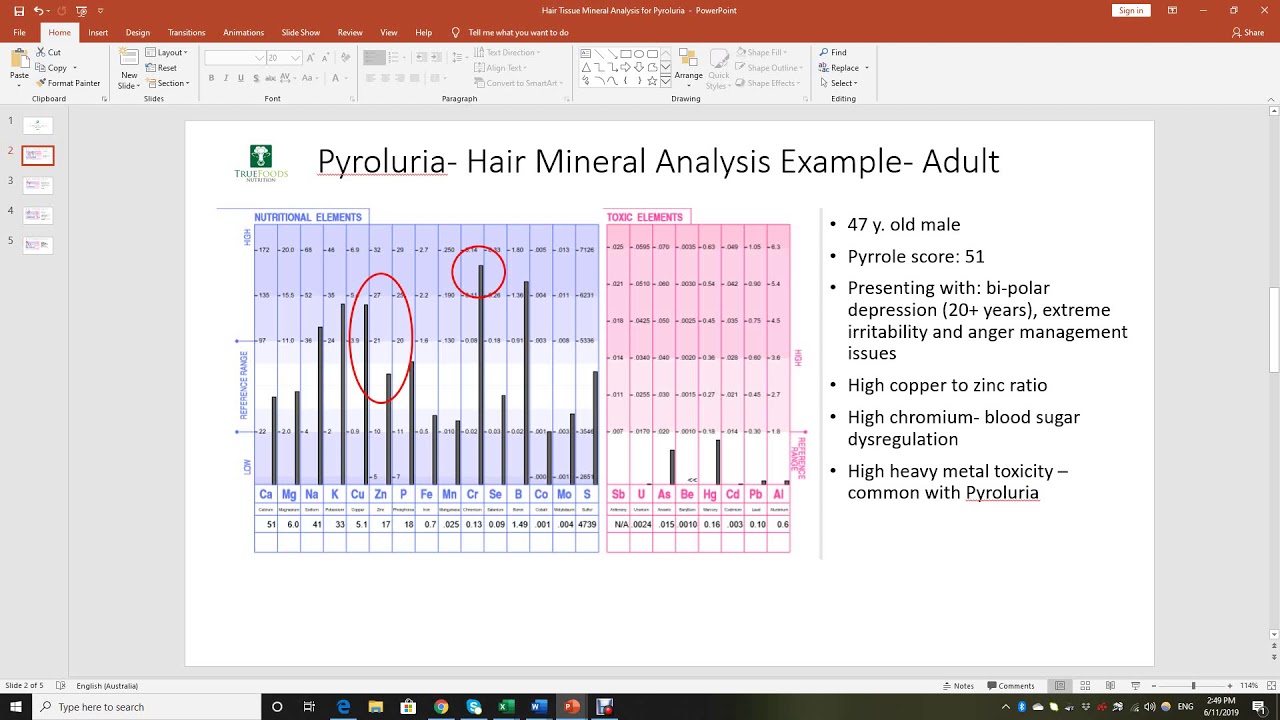 Hair Mineral Analysis for Pyroluria