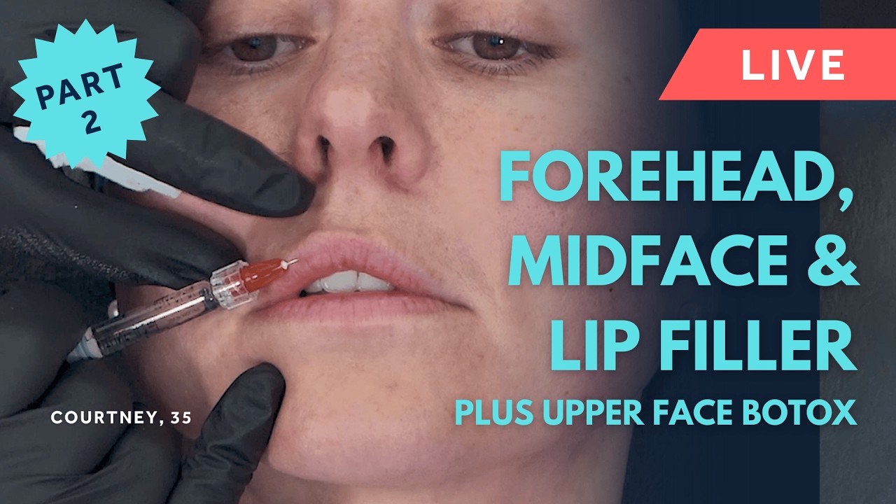 Live Forehead Filler, Lip Filler & Midface Filler Treatments Using Evidence-Based GEM©️ Techniques