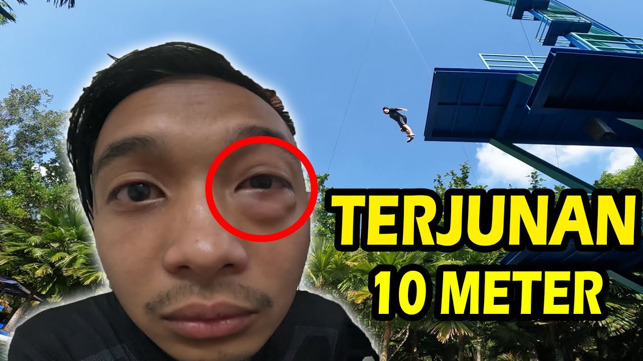 MATA BENGKAK TERJUN 10 METER - DOKTOR SURUH BEDAH !
