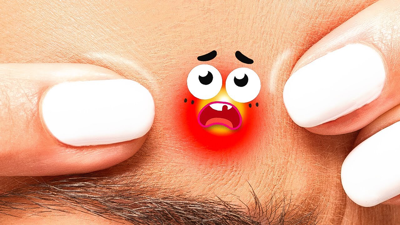 AUCH! Doodles VS Food Surgeries |Embarrassing Moments & Daily Problems Doodles by Doodland