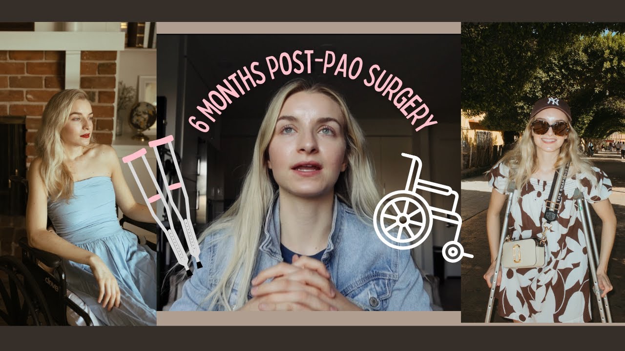 6 Months Post PAO Surgery | My Honest Hip Dysplasia Recovery Journey #hipdysplasia #paosurgery