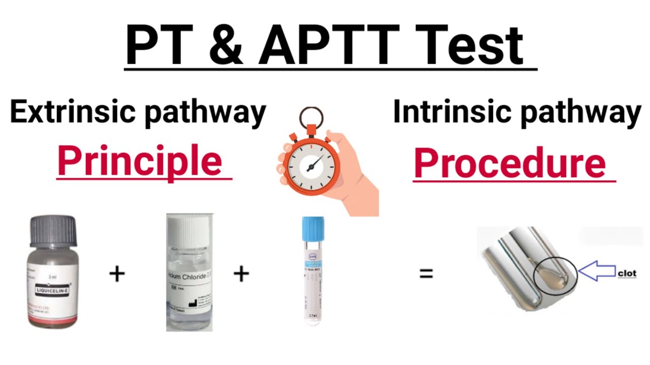 #APTT test || Activated partial Thromboplastin time test || Coagulation pathway in Hindi