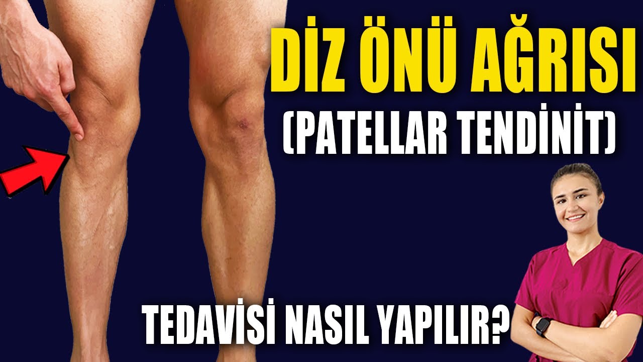 PATELLAR TENDİNİT TEDAVİSİ