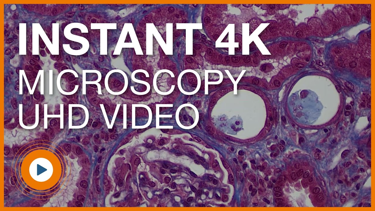 The Sharpest Details - 4K UHD Pathology Video