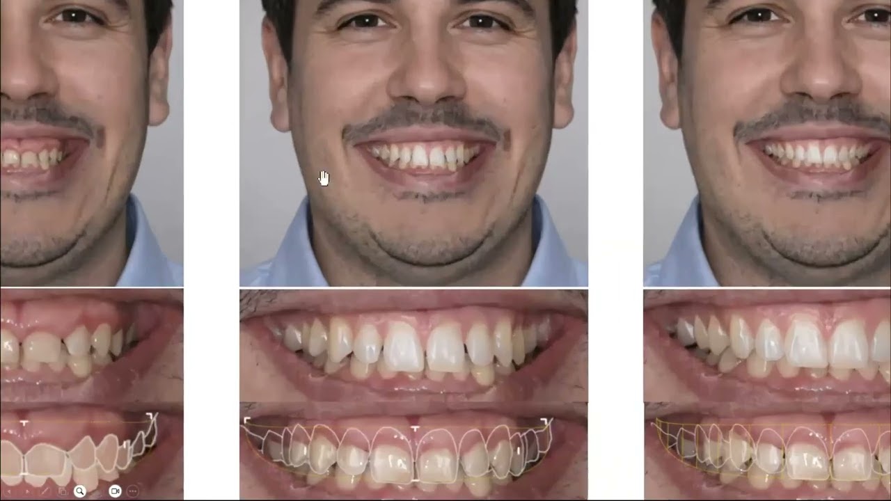smilecloud 3dna