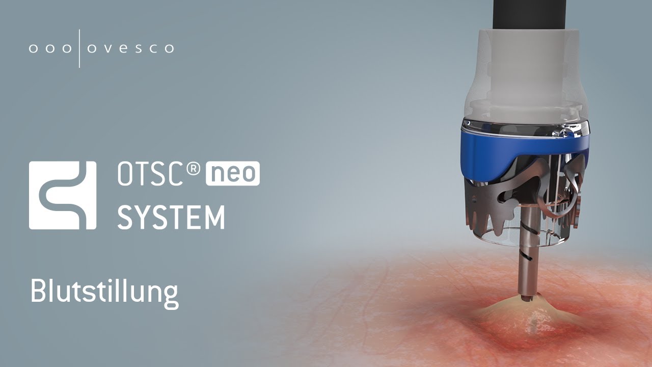 OTSC&reg;neo | H&auml;mostase