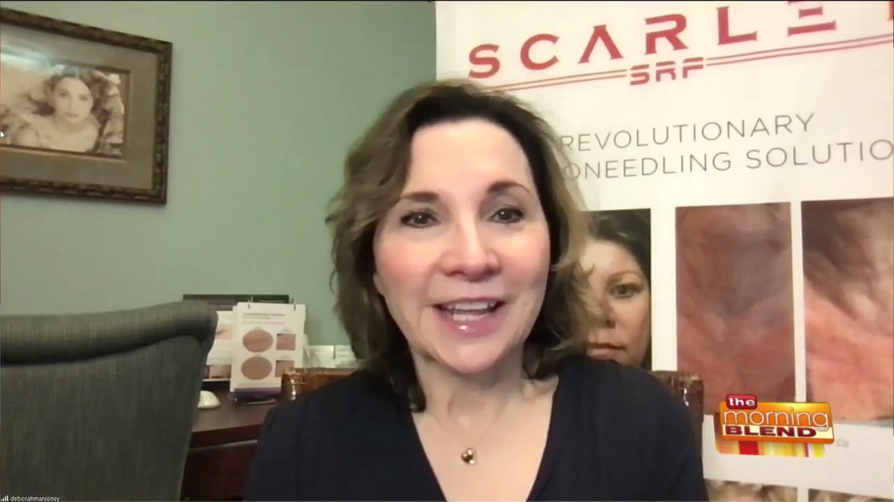 Introducing Scarlet SRF Microneedling - Tighten & Lift Skin with NO Downtime! | The Morning Blend