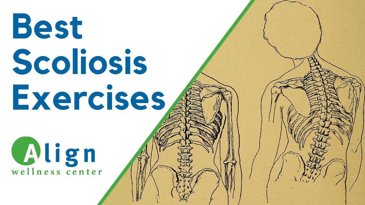 Scoliosis Exercises For Children Ages 10-18
