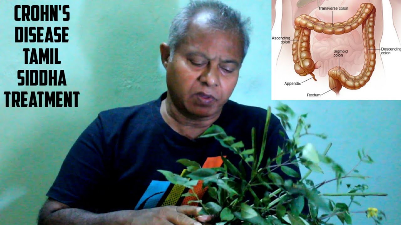 Crohn's Disease Natural Siddha Cure in Tamil