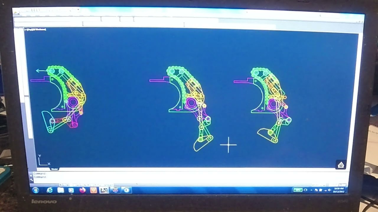 How my New Prosthetic Finger Works