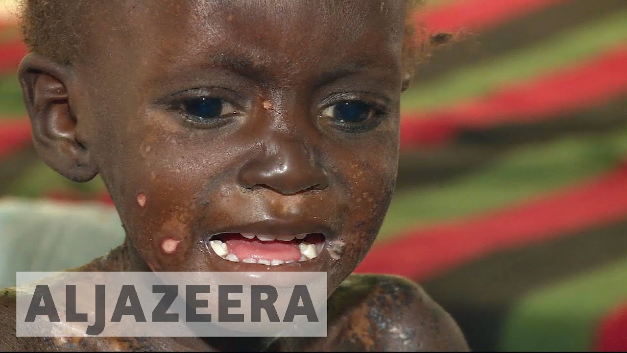 Nigeria&rsquo;s food crisis claims hundreds of lives