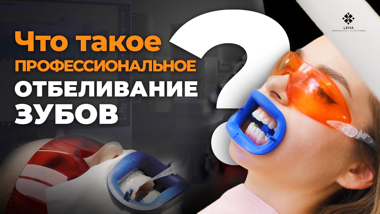 🤍 Что такое профессиональное отбеливание зубов? - Стоматологическая клиника Lema