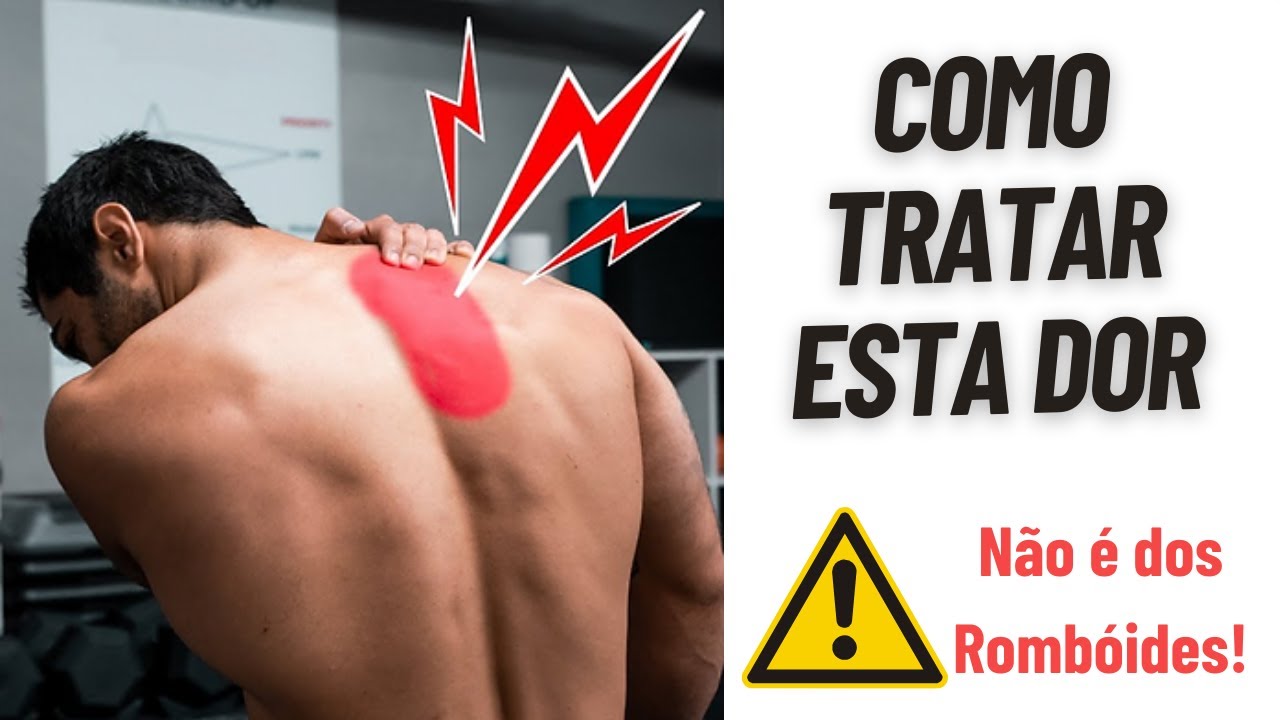 Dor na Escápula | O Verdadeiro Problema e Exercícios para Tratar