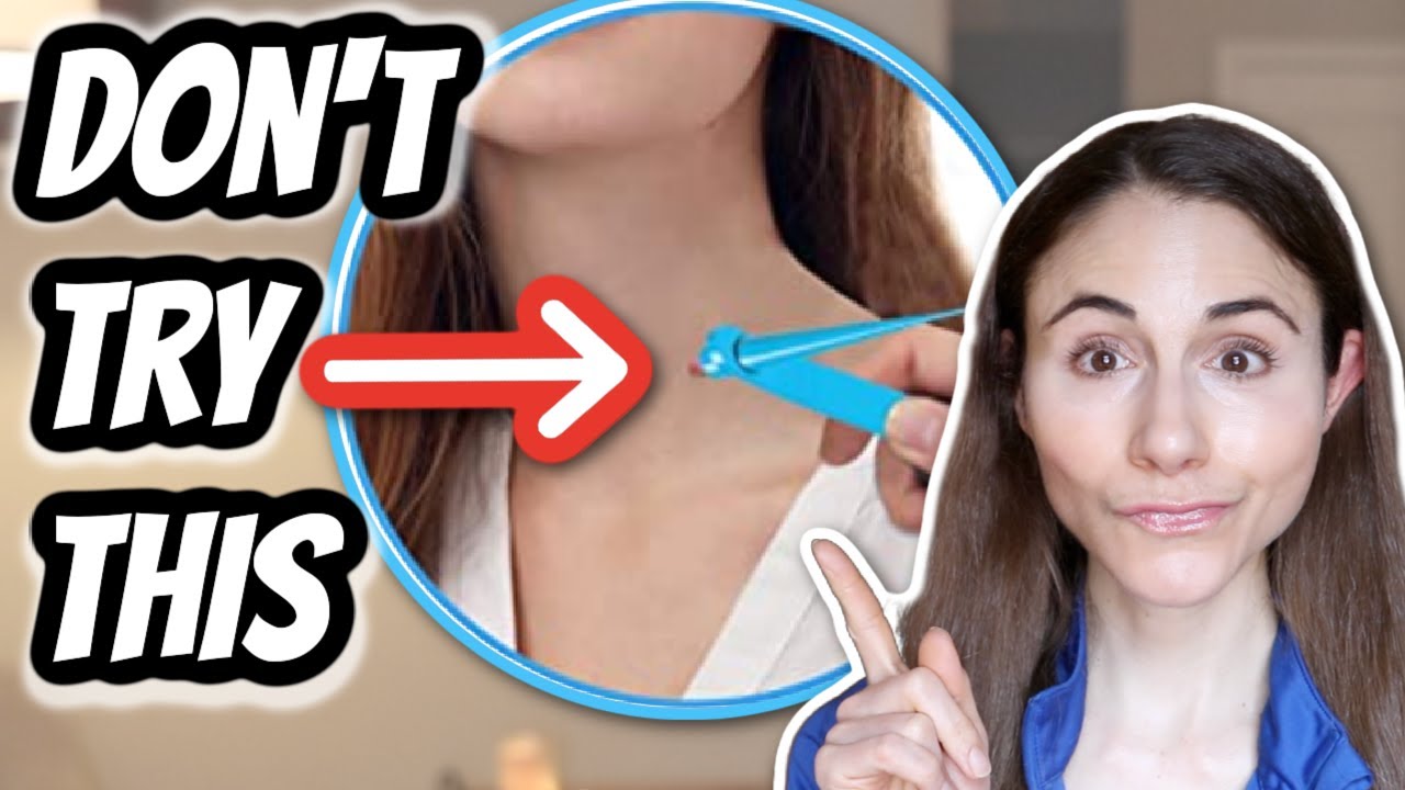 FDA WARNS AGAINST SKIN TAG & MOLE REMOVAL PRODUCTS 😮 DERMATOLOGIST @DrDrayzday
