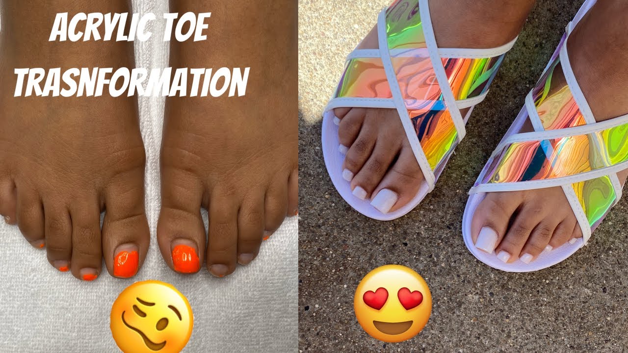 Acrylic Toe Transformation🔥😱😍‼️