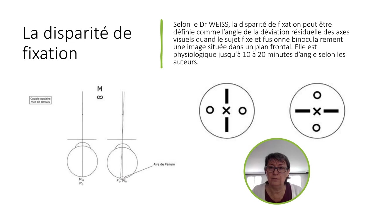 Disparit&eacute; de fixation