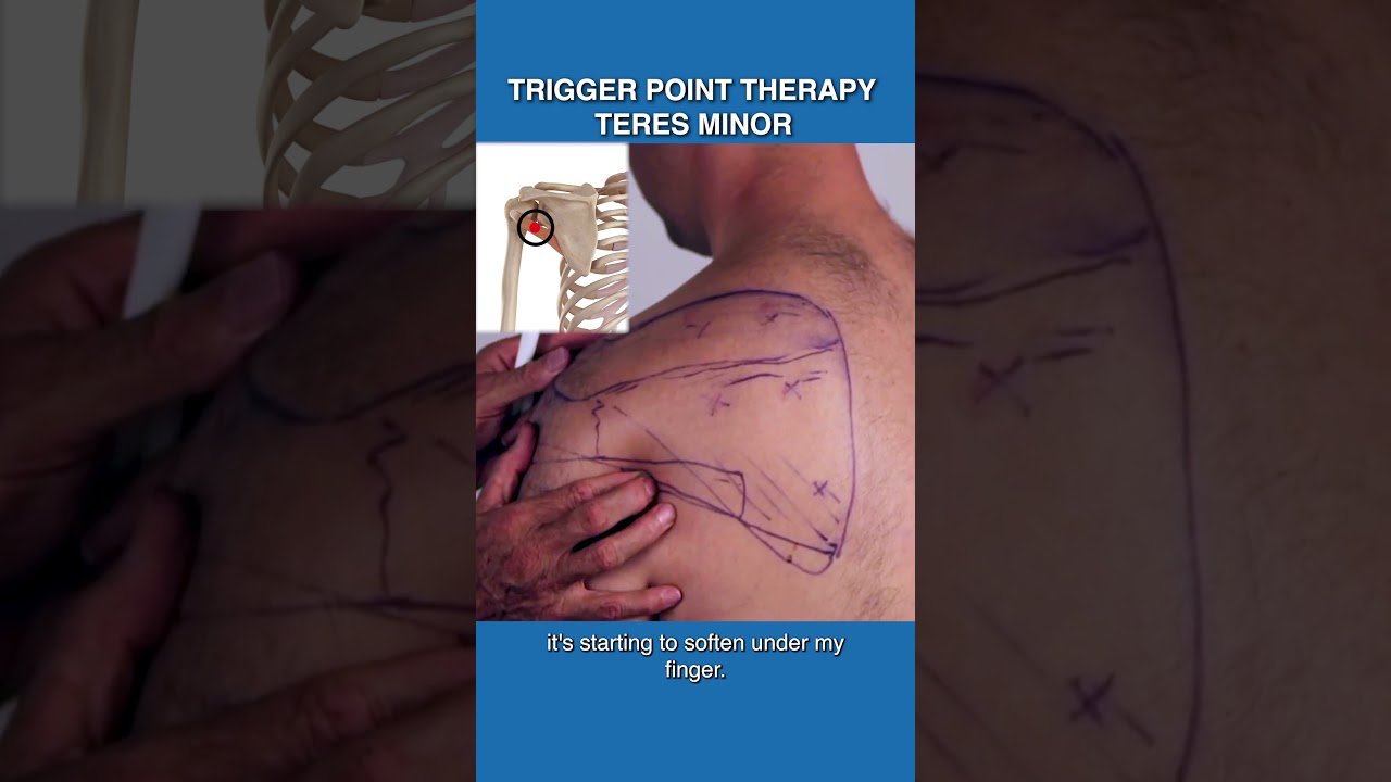 Releasing Teres Minor Trigger Points