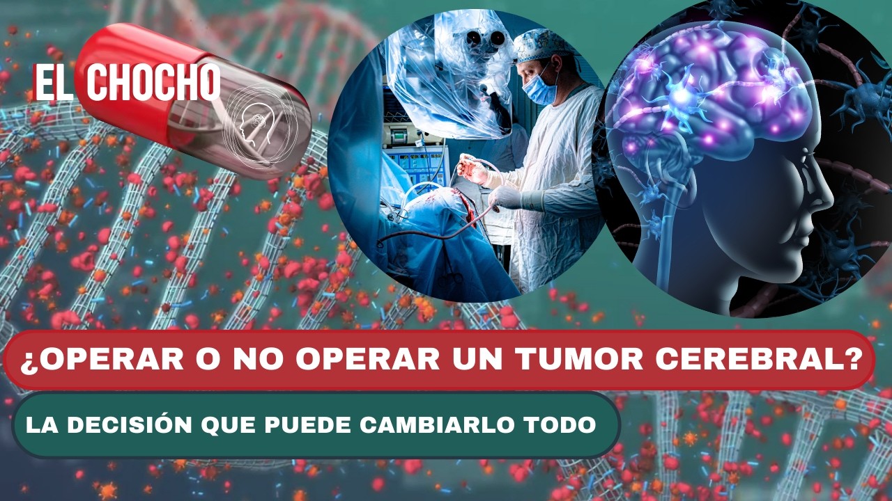Tumores Cerebrales: ¿Cuándo Operar y Cuándo NO?   | El chocho  #adnnoticiasradio