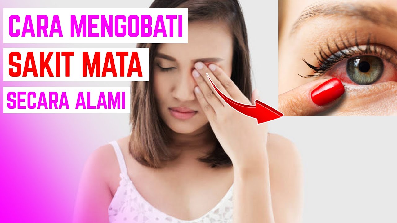 SAKIT MATA! CARA MENGOBATI MATA MERAH SECARA ALAMI