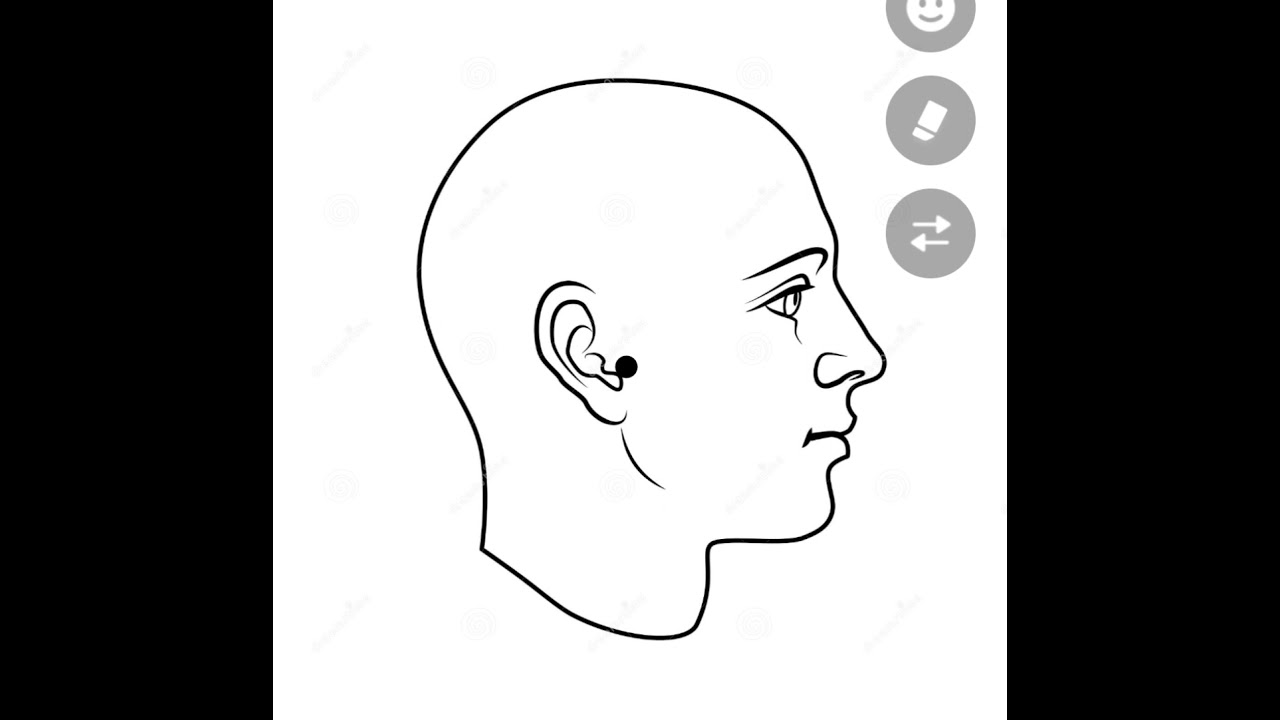 Surface Marking Of Parotid Duct || parotid Duct Anatomy ||