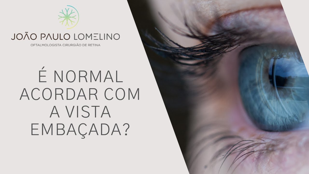 &Eacute; normal acordar com a vista emba&ccedil;ada? | Dr. Jo&atilde;o Paulo Lomelino
