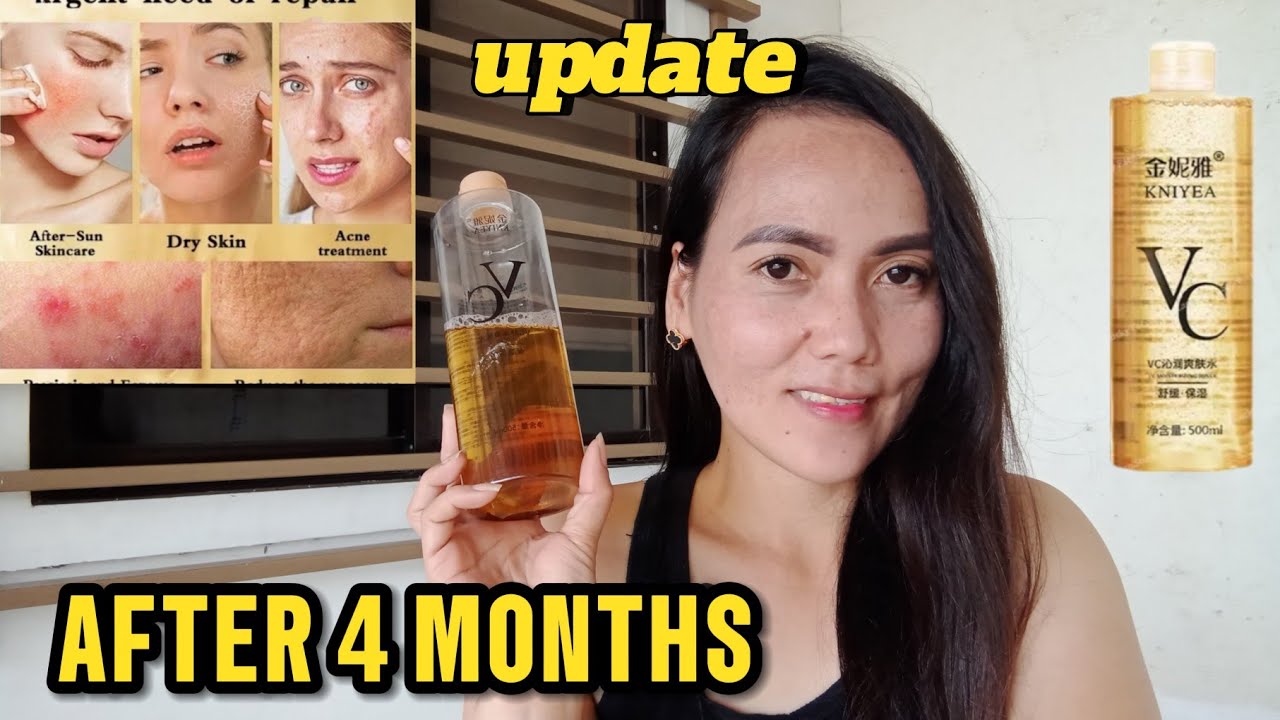 UPDATE : VITAMIN C TONER KNIYEA REVIEWS| momshie weng