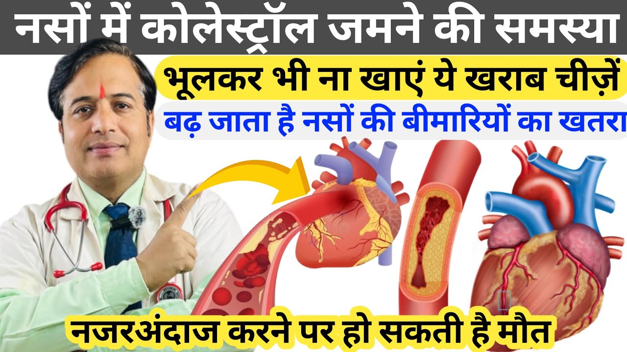 नसों में कोलेस्ट्रॉल जमने की समस्या || Cholesterol Kya khane se Badhta hai || Top Foods To Avoid For