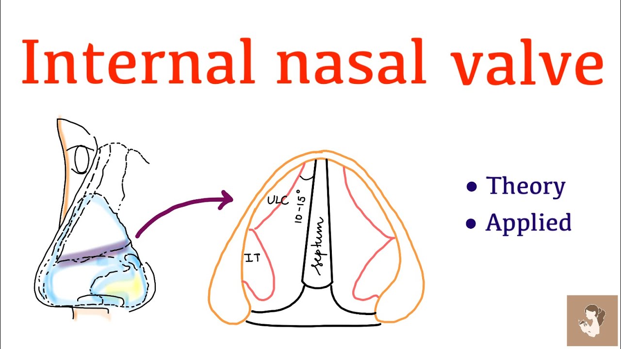 Internal nasal valve | Nose anatomy | Concise explanation | ENT | MBBS