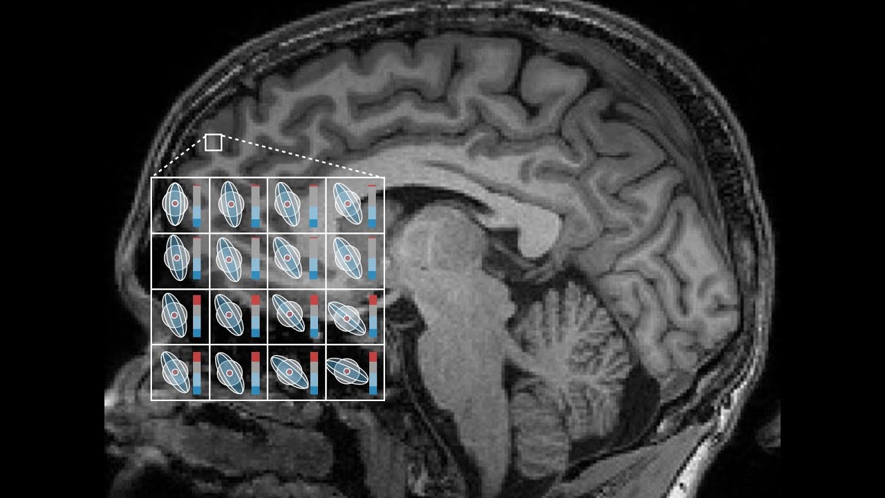 Introduction to Diffusion-Weighted MRI and Microstructure Imaging