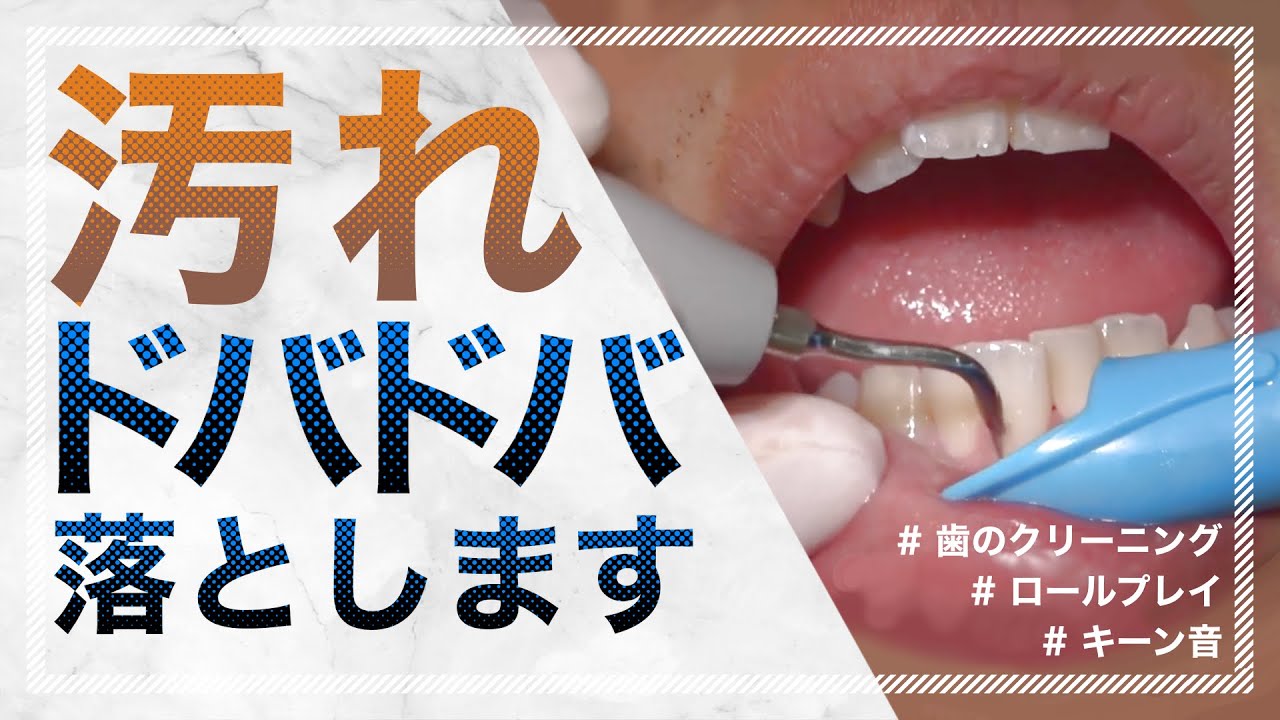 【歯列矯正】マウスピース矯正中のクリーニングを全部見せ！